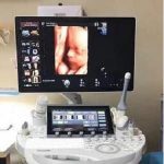 全景四维彩超和普通彩超有什么区别