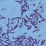 疑问：石女为什么要进行菌群置换（换菌）