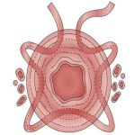 宫颈机能不全导致的不孕救助信-孩子，我何时才能拥有你