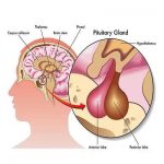 闭经是怎么一回事？闭经综述-陈凤林