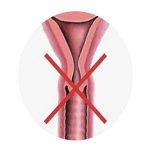 北京安太医院给石女的五条建议