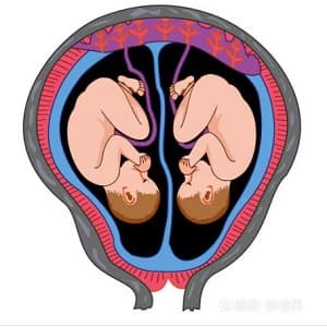 双胎