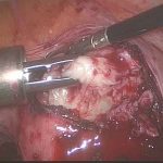 想尽快怀孕但又条件不足怎么办？