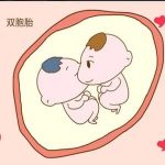 双胎一个问题儿怎么办？