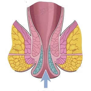 肛脱