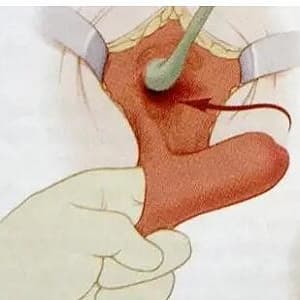 变性