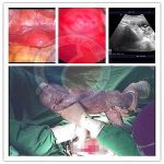 【闭经】30岁从未来月经 安太唤醒卵巢后生了孩子！