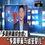 【视频】多囊卵巢是否应该选择试管婴儿?