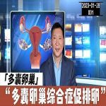 【视频】多囊卵巢综合症如何促排卵？