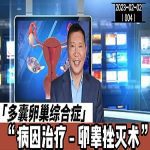 【视频】多囊卵巢综合症的对因治疗之卵睾挫灭术