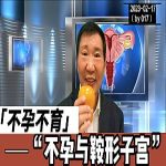 【视频】不孕不育与鞍形子宫