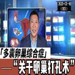 【视频】多囊卵巢综合症与卵巢打孔术