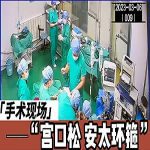 【手术现场】宫口松安太环箍