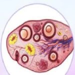 了解卵巢早衰：原因、特点、治疗及激素替代疗法