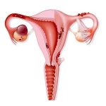 Ovarian Infertility – Scientific Rescue of Ovarian Adhesions