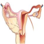 Breaking the Infertility Barrier:Dr.Antai Yang Shuhua’s Innovative Method for Natural Conception