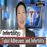 Breaking Through Infertility Barriers: A New Treatment Approach for Tubal Adhesion