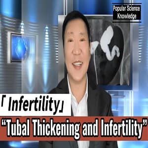 Infertility and excessively thick fallopian tubes
