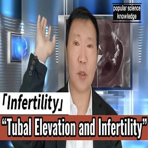 Tubal Uplift and Infertility