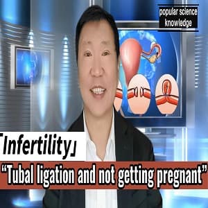 tubal ligation