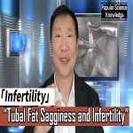 Tubal Adiposal Descent and Infertility: Innovative Solution from Beijing Antai Hospital