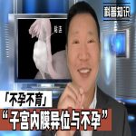 盆腔因素导致的不孕症——子宫内膜异位症