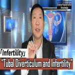 Infertility and Tubal Diverticulum – Understanding the Causes and Treatment Options