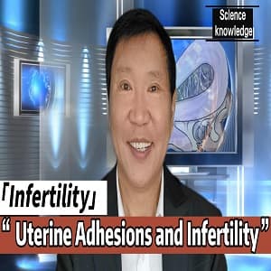 Uterine Adhesions and Infertility