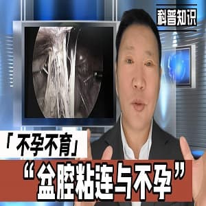 盆腔粘连与不孕