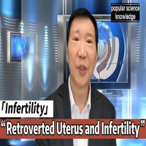 Retroverted uterus